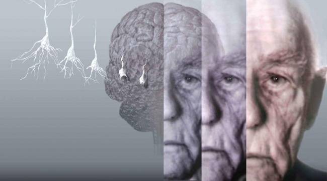 В США найден способ выявлять болезнь Альцгеймера по анализу крови — Технологии, Новости США