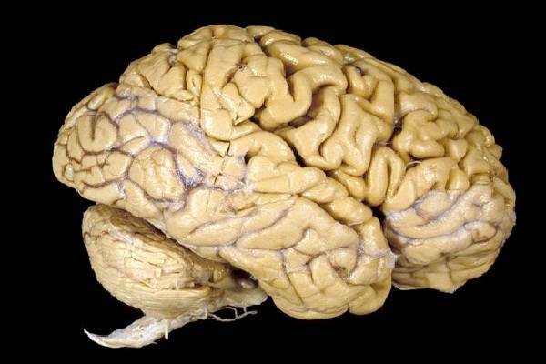 Почему наш мозг начал сокращаться 20 тысяч лет назад?
