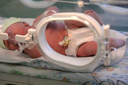 В России смогут выхаживать младенцев после тяжелой асфиксии при рождении