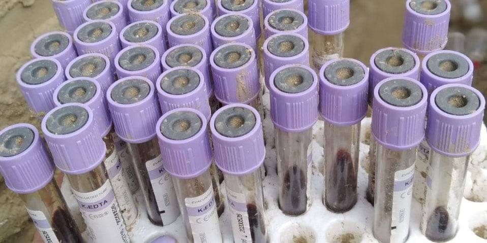 Свалку лабораторных пробирок с кровью нашли в Актау (фото)