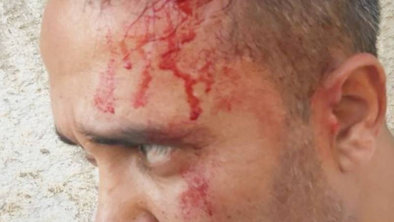 Ташкентского блогера жестоко избили арматурой &nbsp; | Вести.UZ