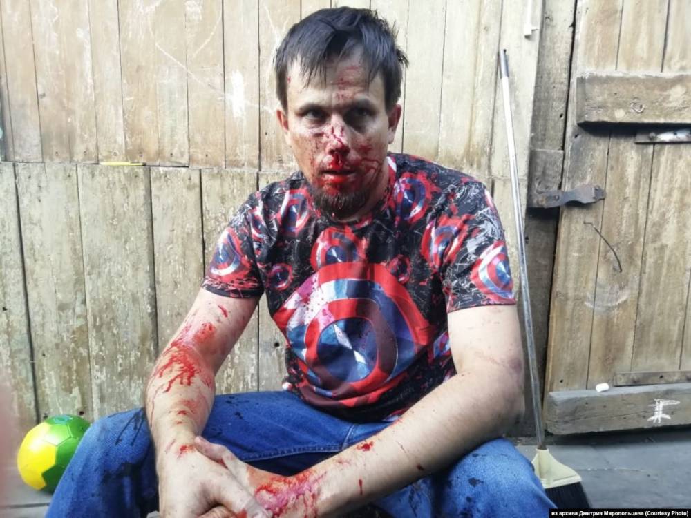 Кузбасский оппозиционный активист рассказал об избиении
