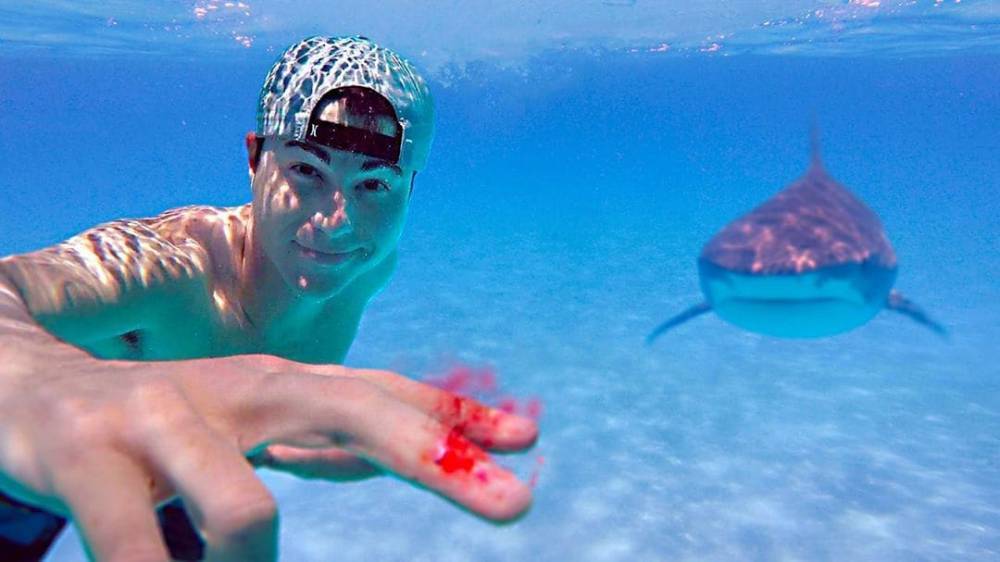 Акулы чувствуют кровь за несколько миль: блогер проверил на себе (фото, видео)