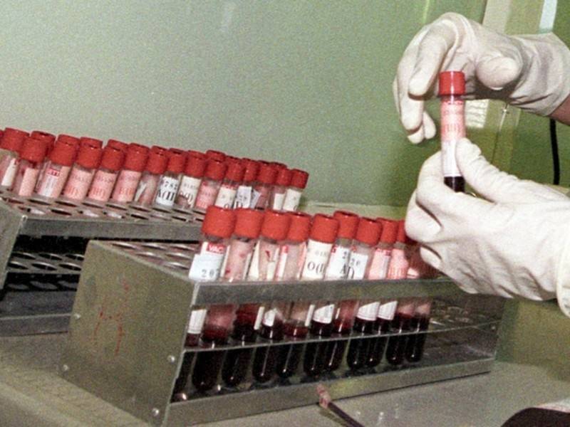Учёные открыли механизм, убивающий СПИД