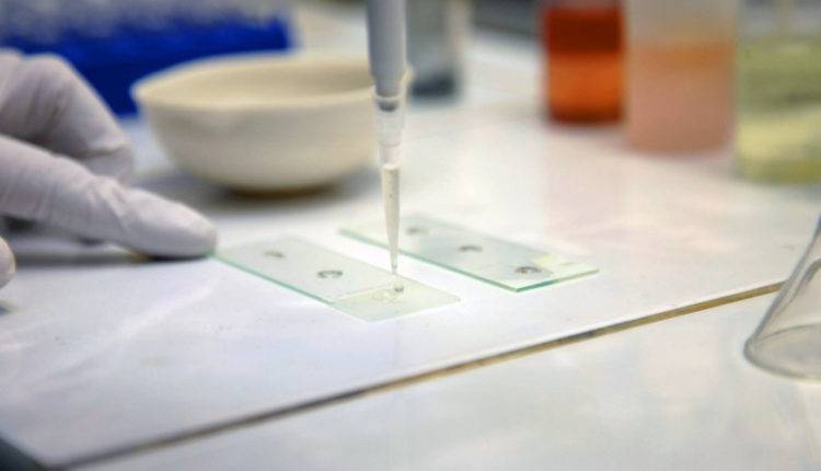 Ученые нашли способ защиты от ВИЧ благодаря червям-паразитам