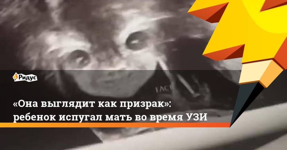 «Она выглядит как призрак»: ребенок испугал мать во время УЗИ