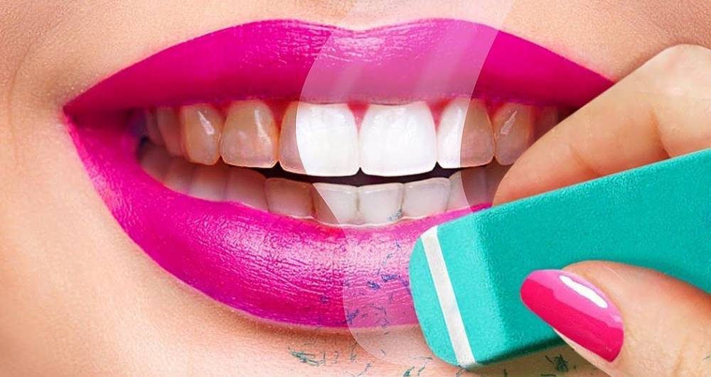 9 способов отбеливания зубов в домашних условиях