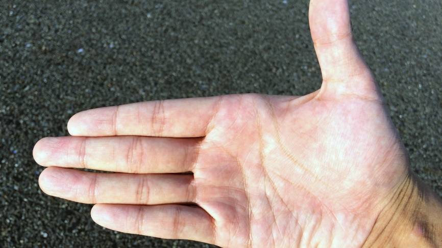 Названы пять опасных причин онемения в пальцах рук