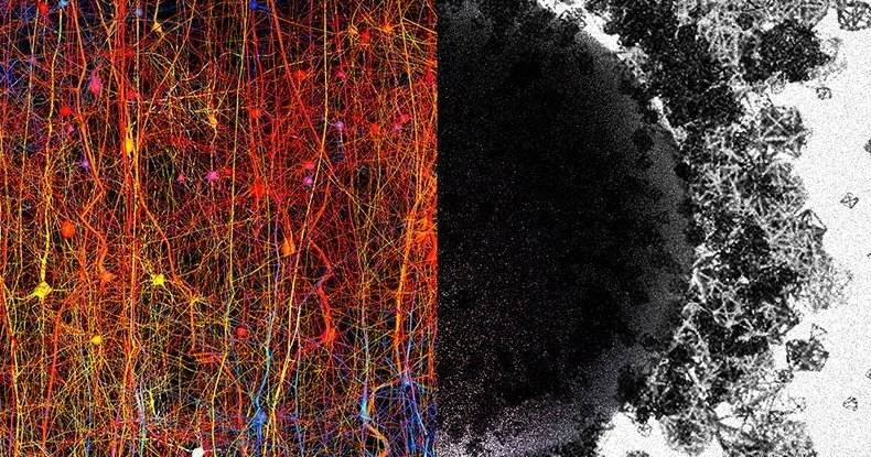 В мозгу человека обнаружены структуры, существующие в&nbsp;11 измерениях