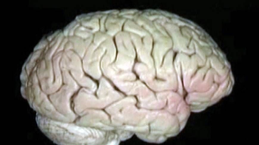 Неврологи выяснили, что превращает человека в серийного убийцу