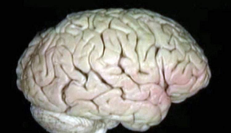 Неврологи выяснили, что превращает человека в серийного убийцу