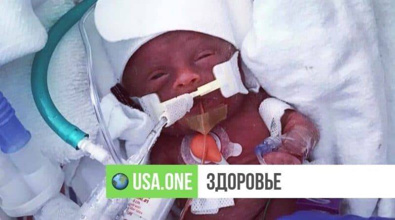 Недоношенный ребенок, который при рождении весил 500 г, вернулся домой после 113 дней в отделении интенсивной терапии
