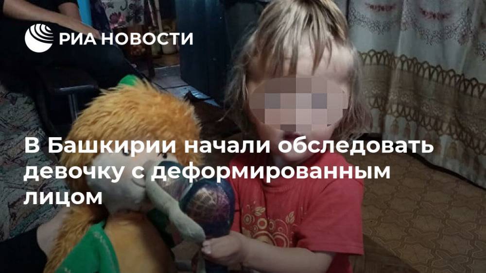 В Башкирии начали обследовать девочку с деформированным лицом