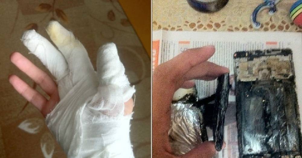 Челябинский школьник пострадал из-за внезапного возгорания смартфона.