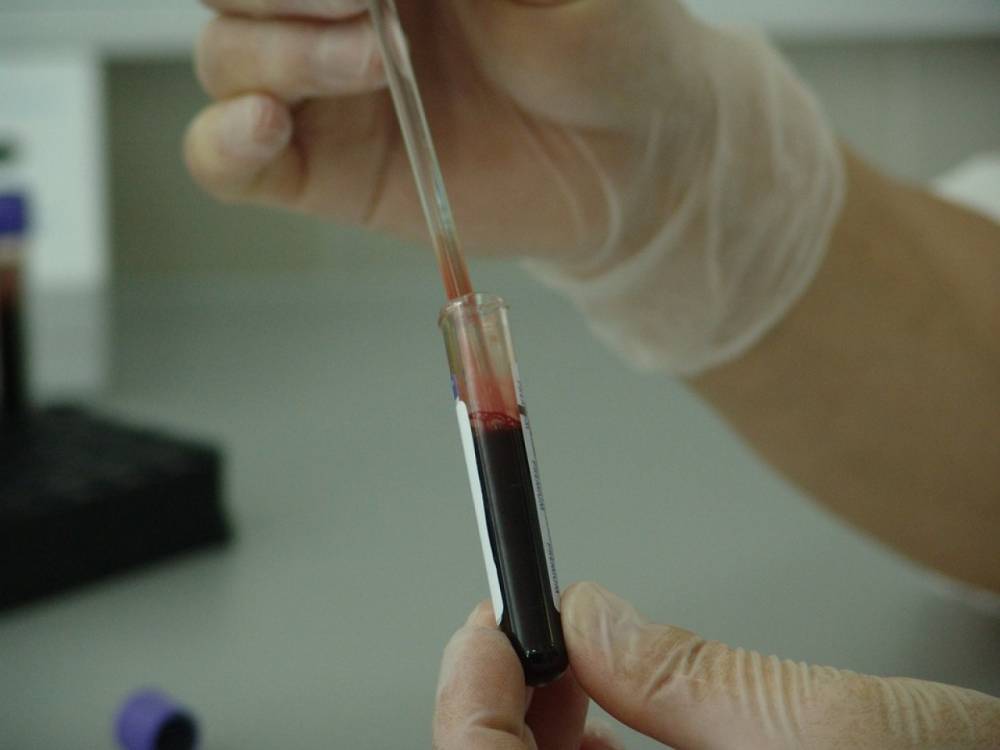 В Петрозаводске увеличились выплаты для доноров крови и ее компонентов