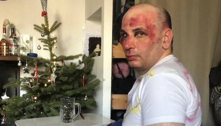 Хулиганы жестоко избили учителя истории в Пятигорске