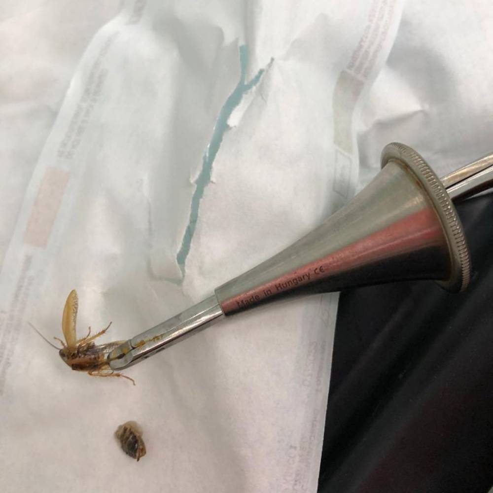 Жаловался на боли: кемеровчанин пришёл в больницу с насекомым в ухе