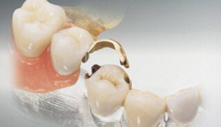 Имплантация зубов в Москве – высокая квалификация, выгодные цены