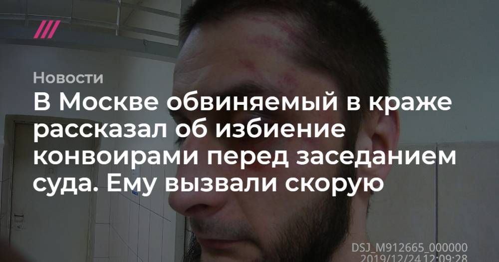 В Москве обвиняемый в краже рассказал об избиение конвоирами перед заседанием суда. Ему вызвали скорую
