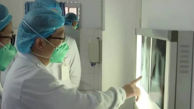 Увеличилось число погибших от нового типа коронавируса в Китае