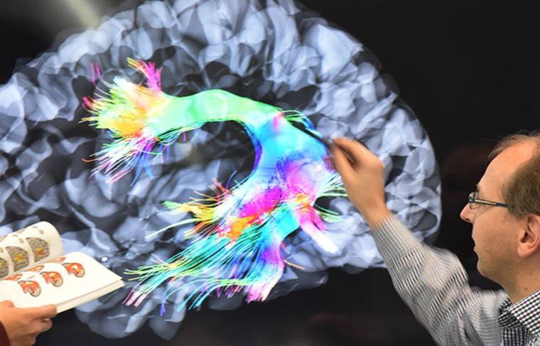 Учёные выяснили, как размер мозга влияет на уровень интеллекта