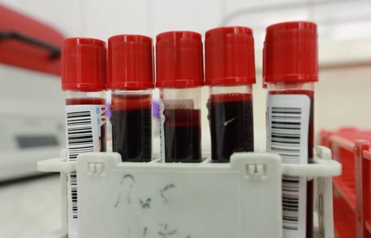 Четверых людей проверяют на заражение коронавирусом в Австралии
