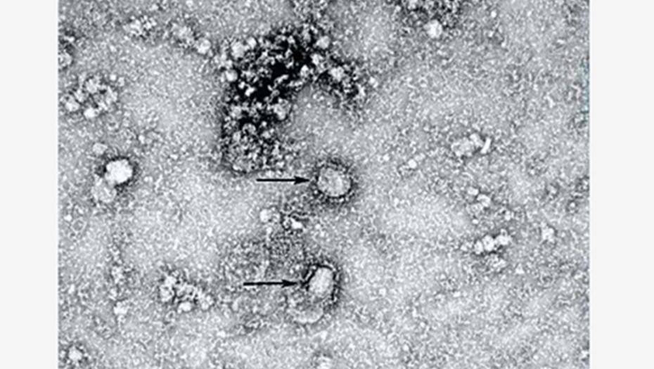 Китайские ученые показали снимок опасного коронавируса