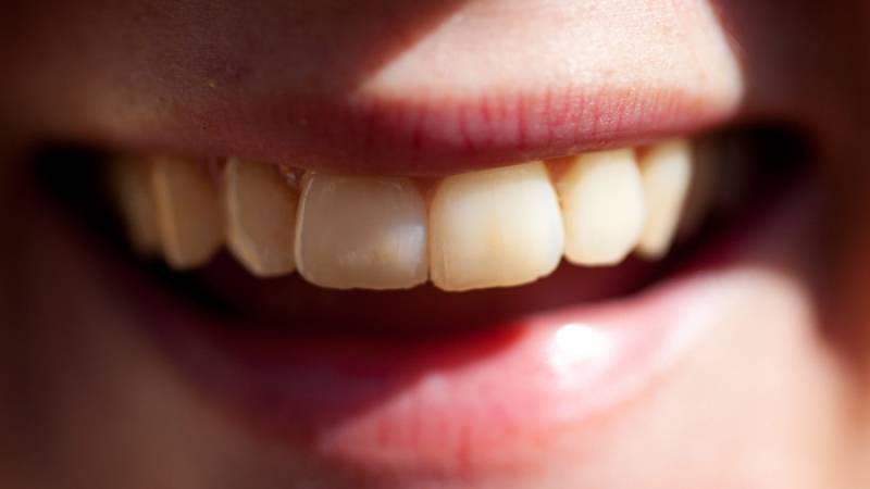 Ученые создали эффективное антикариесное покрытие для зубов