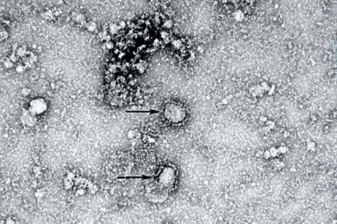 Ученые показали первый снимок китайского коронавируса