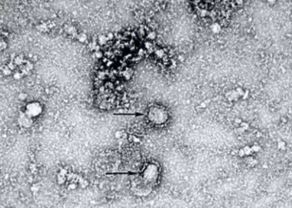 Китайские ученые установили источник коронавируса