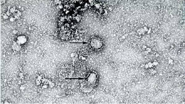 Австралийские ученые смогли вырастить новый коронавирус