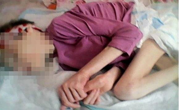 Власти прокомментировали ситуацию с больной девочкой, о которой рассказал депутат Шаргунов