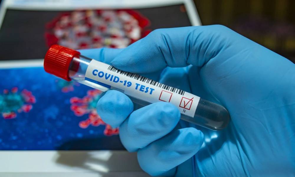 В Украине за сутки подтвердили 5728 новых случаев коронавируса