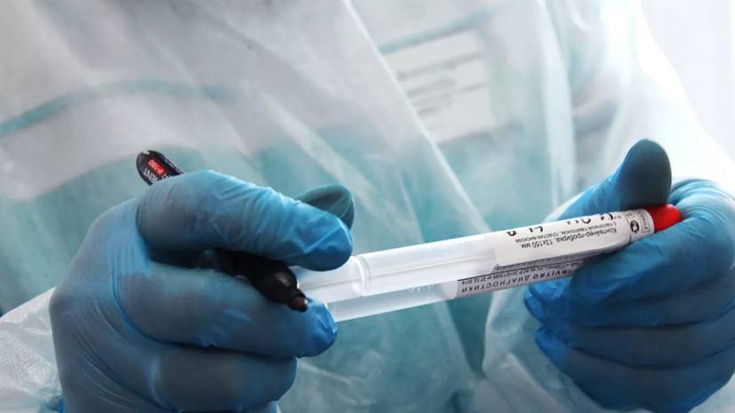 За сутки в Узбекистане выявили 329 случаев коронавируса