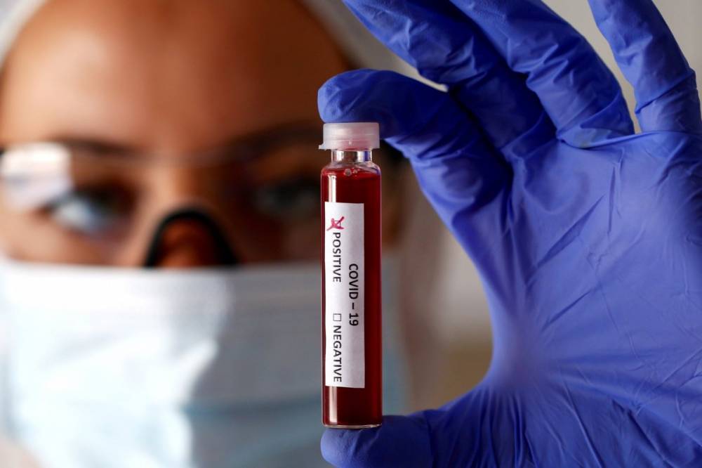 В мире впервые умер человек от повторного заражения коронавирусом