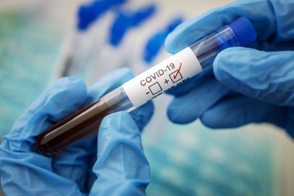 В Украине коронавирус продолжает набирать темпы: за сутки зафиксировали 5 590 новых случаев