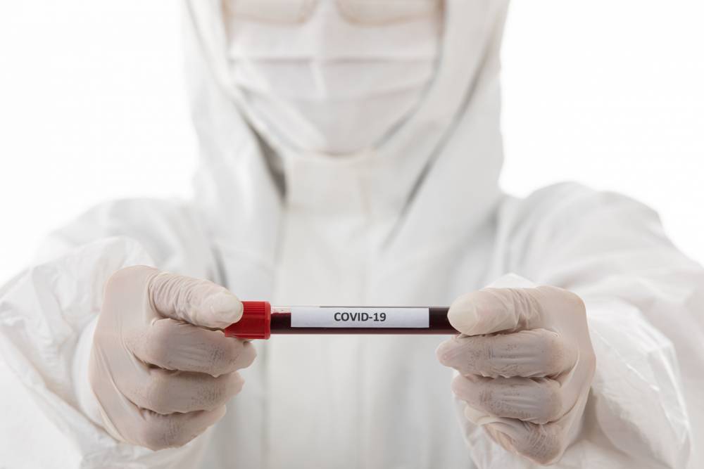 Новый антирекорд: За сутки 4 633 человека заболели коронавирусом