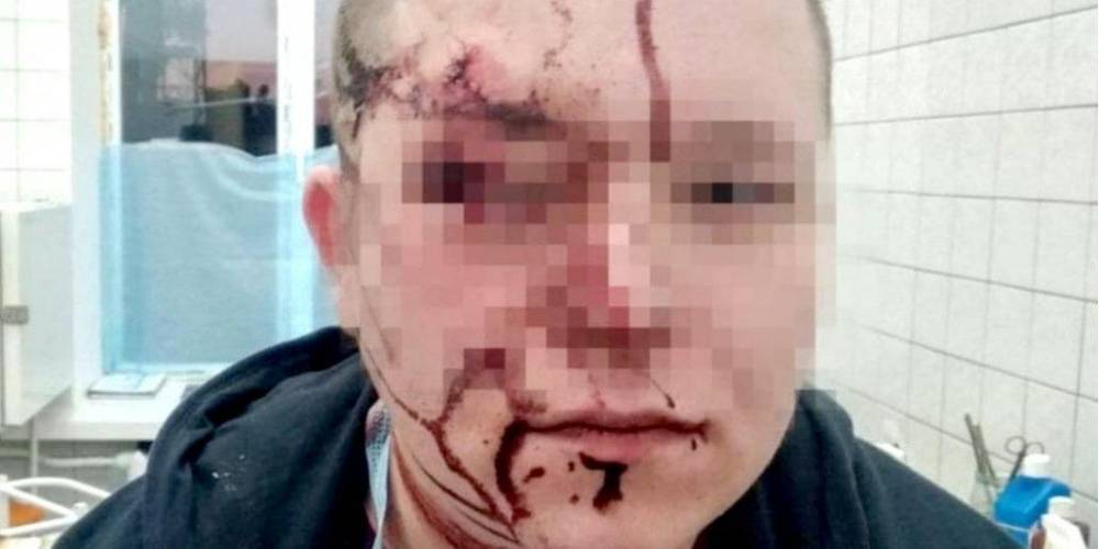 Соцсети: в Киеве пациент разбил врачу голову стулом — фото