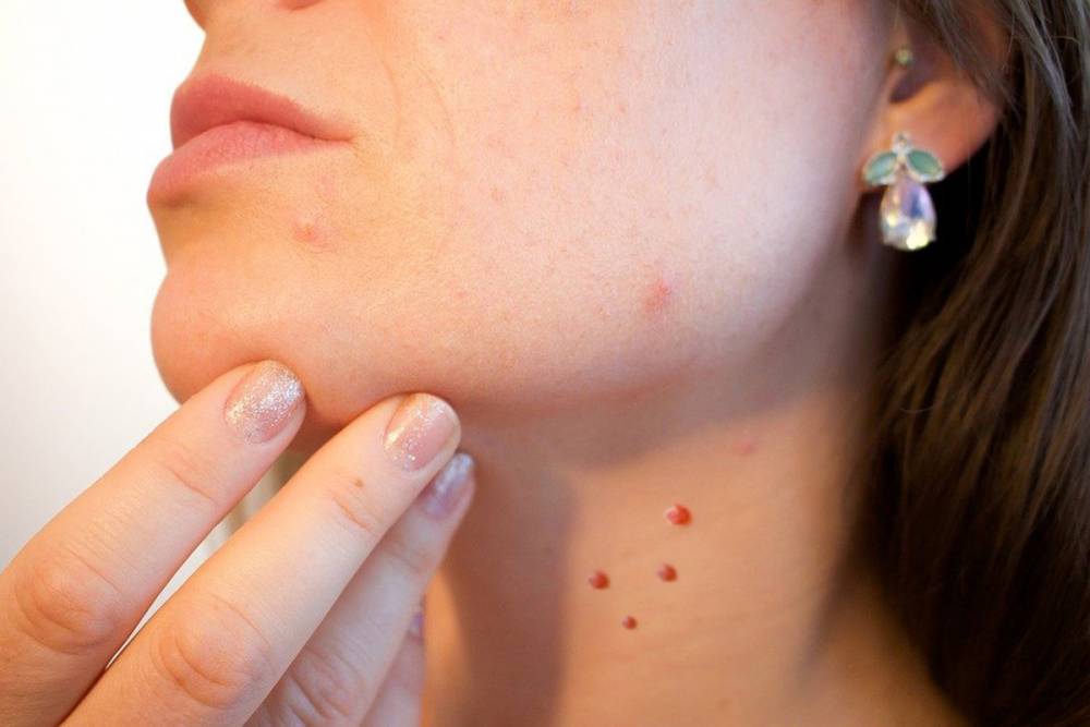 О прививке от папилломы рассказал врач-косметолог из Волгограда