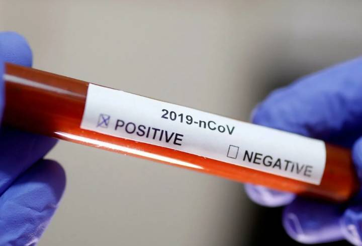 87 новых случаев коронавируса зафиксировали в Ленобласти за последние сутки