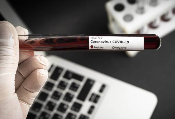 91 новый случай коронавируса выявили в 11 районах Ленобласти за последние сутки