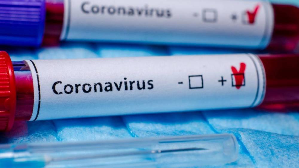 Новые случаи заболевания коронавирусом зарегистрировали в Казахстане