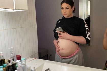 Родившаяся с мужскими гениталиями девушка-трансгендер забеременела