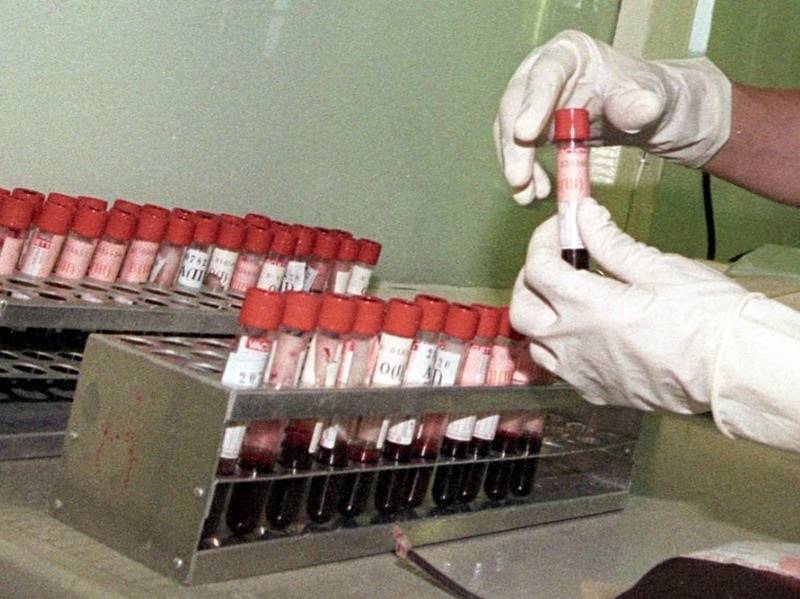 В семи регионах пациенты с ВИЧ сообщили о том, что не могут сдать анализ крови