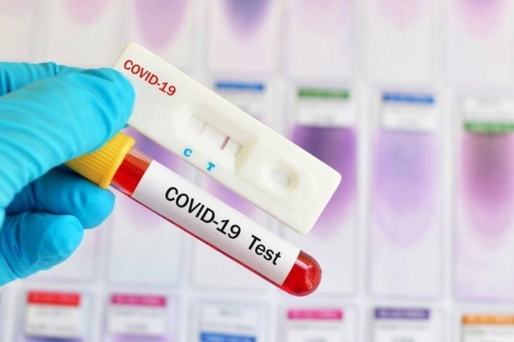 В Украине обнаружили более 661 тыс. случаев коронавируса COVID-19, за последние сутки - 13 882