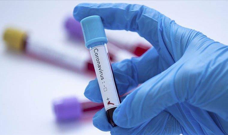 Украина бьет коронавирусные рекорды: более 16 тысяч новых случаев COVID-19 выявлено за сутки