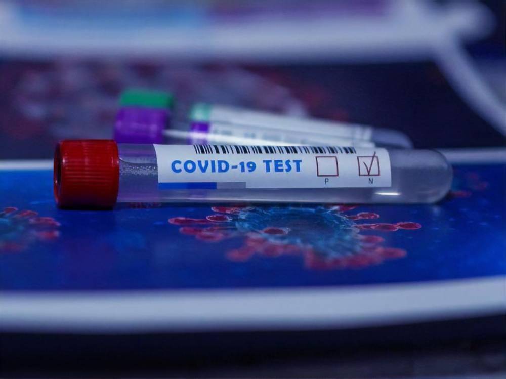Днепропетровская область меньше других регионов охвачена тестированиями на коронавирус – данные Минздрава за неделю