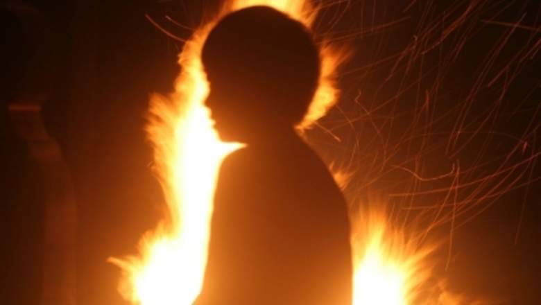 В Бердянске подростки подожгли 12-летнего мальчика