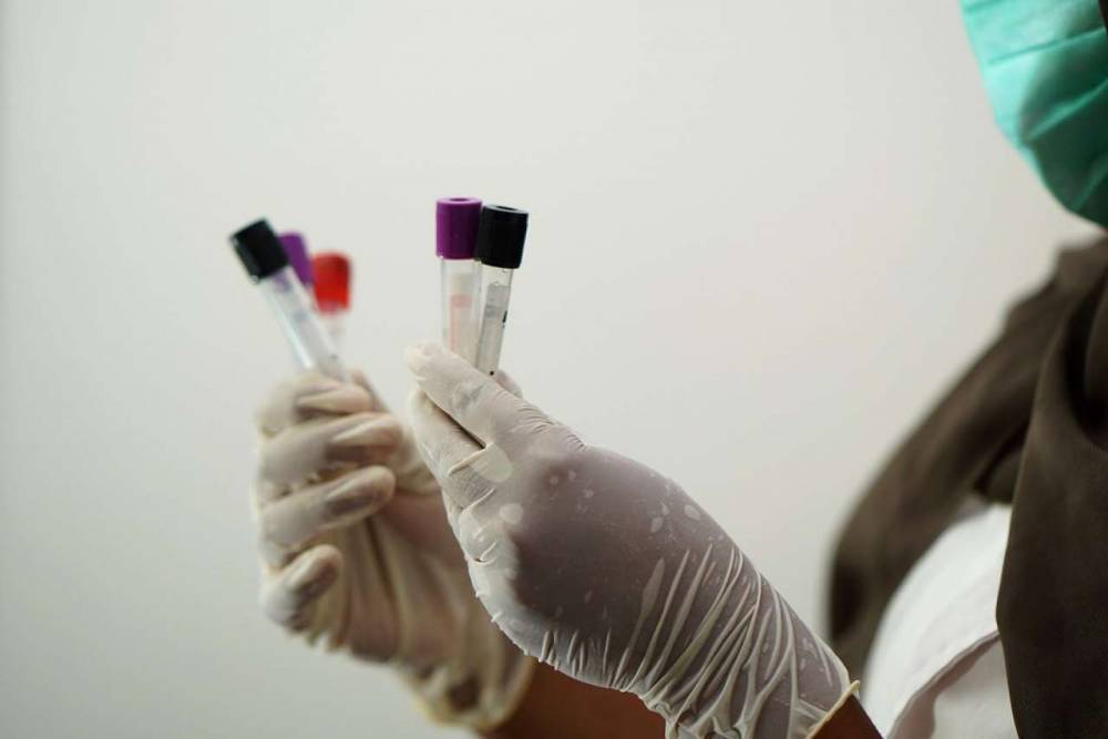 Названы ошибки, которые допускают при получении отрицательного теста на коронавирус