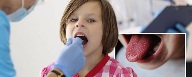 Американские ученые выявили новый симптом коронавируса у детей